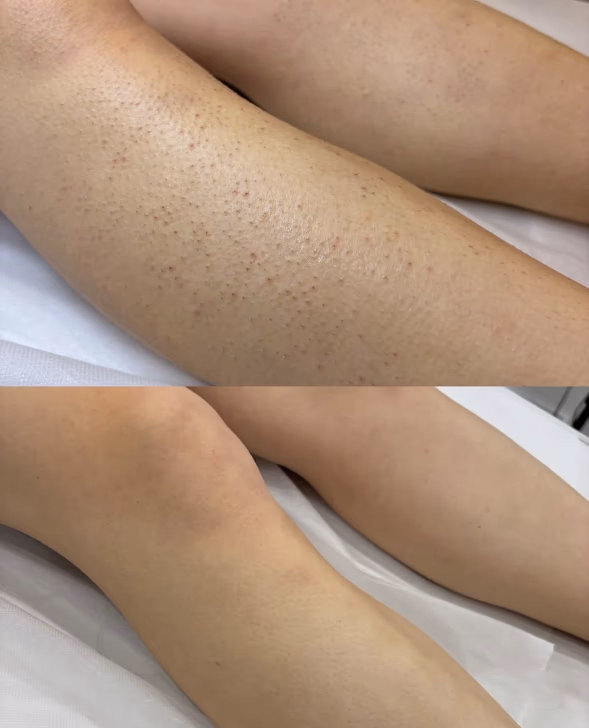 Näohooldused - Image Wrinkle Lift Forte