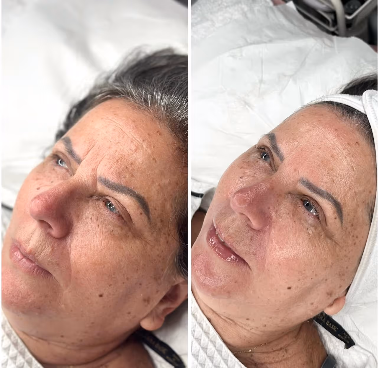 Näohooldused - Image Wrinkle Lift Forte