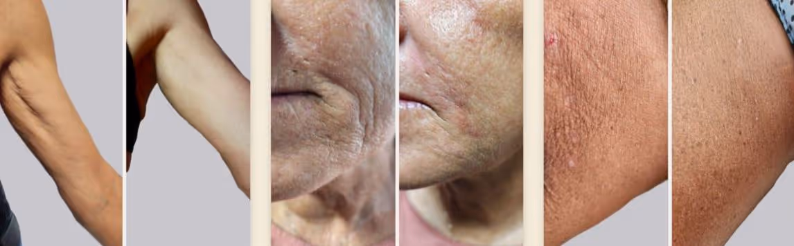 Näohooldused - Image Wrinkle Lift Forte