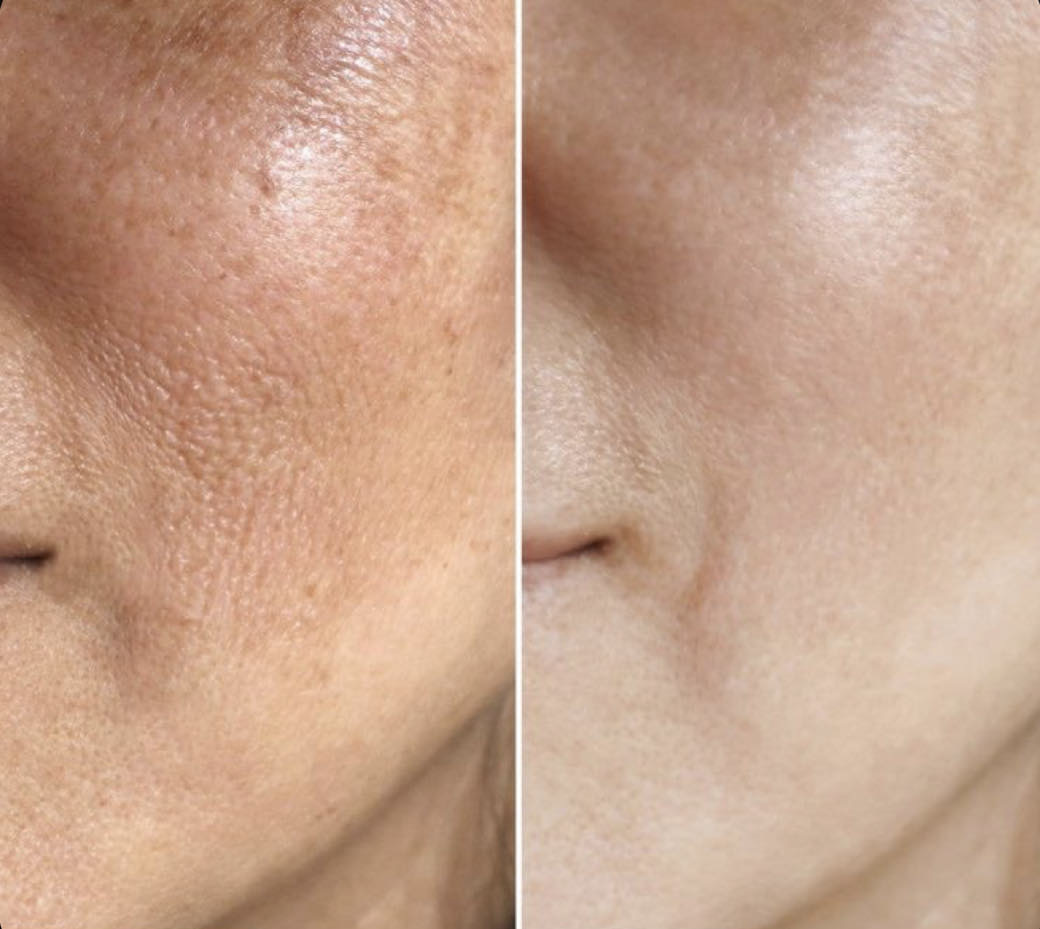 Miks üha rohkem valitakse mittekirurgilised lahendused?