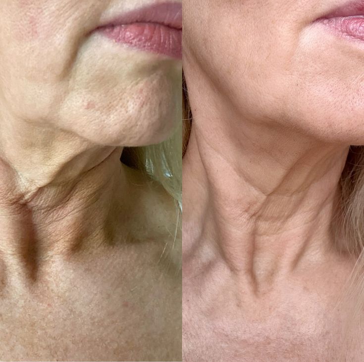 Miks polünukleotiidid on iluravis tõeliseks revolutsiooniks?